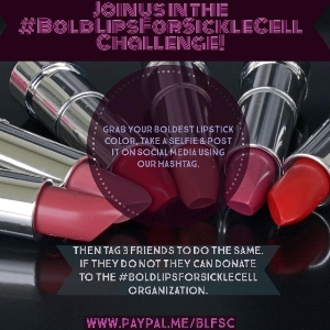 #BoldLipsForSickleCell Challenge